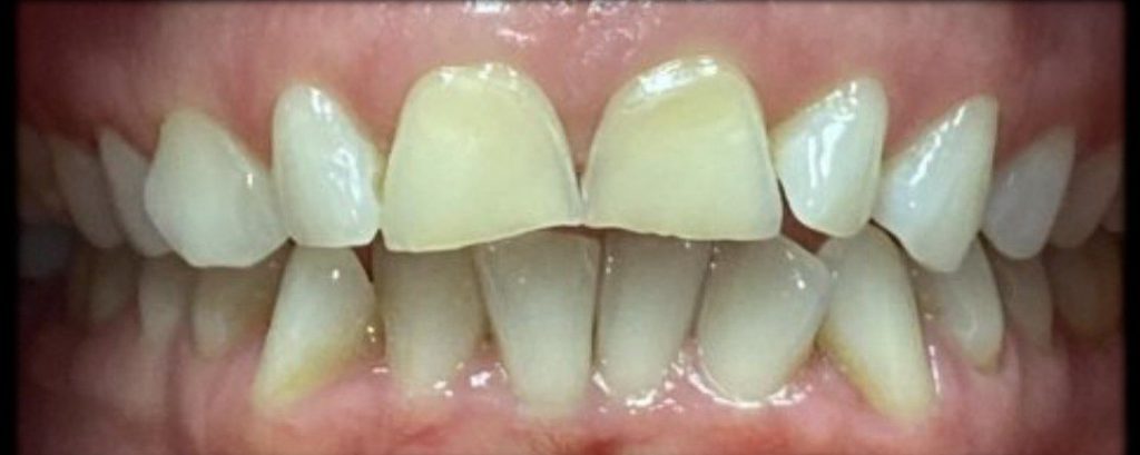 Case 1 Before