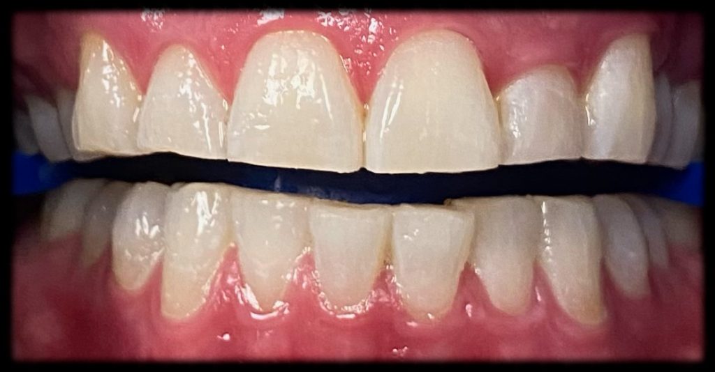 Case 2 After