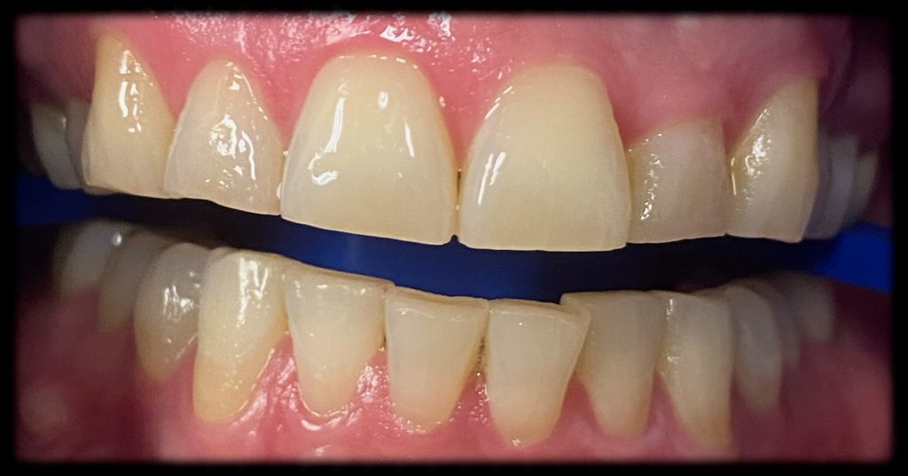 Case 2 Before