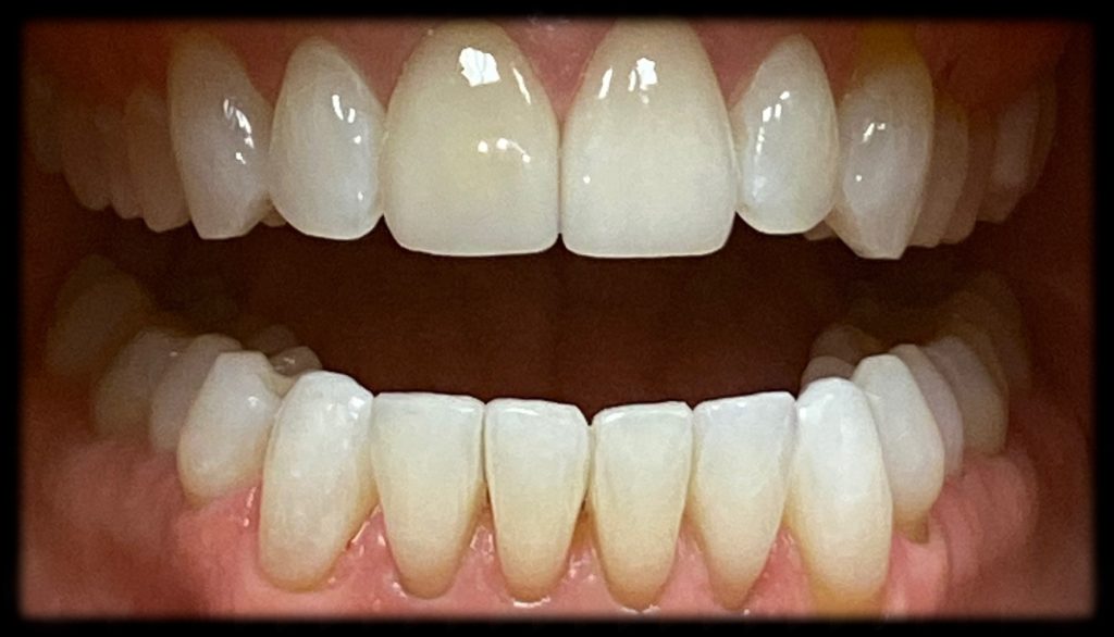 Case 3 After